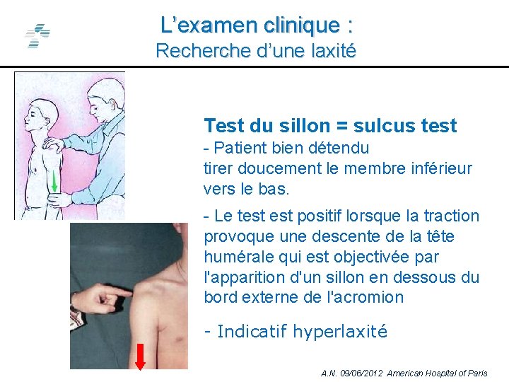 L’examen clinique : Recherche d’une laxité Test du sillon = sulcus test - Patient