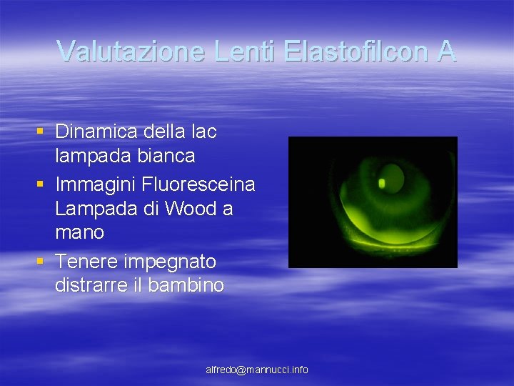 Valutazione Lenti Elastofilcon A § Dinamica della lac lampada bianca § Immagini Fluoresceina Lampada Valutazione Lenti Elastofilcon A § Dinamica della lac lampada bianca § Immagini Fluoresceina Lampada