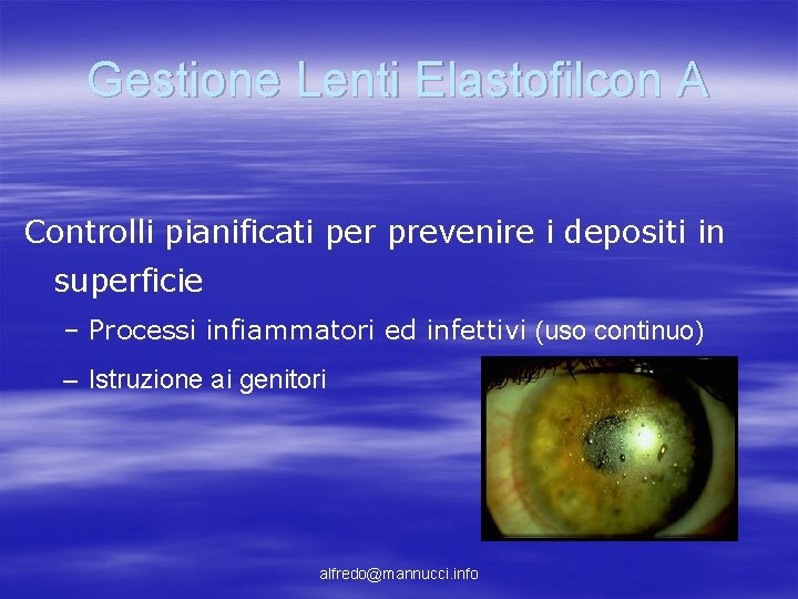 Gestione Lenti Elastofilcon A Controlli pianificati per prevenire i depositi in superficie – Processi Gestione Lenti Elastofilcon A Controlli pianificati per prevenire i depositi in superficie – Processi