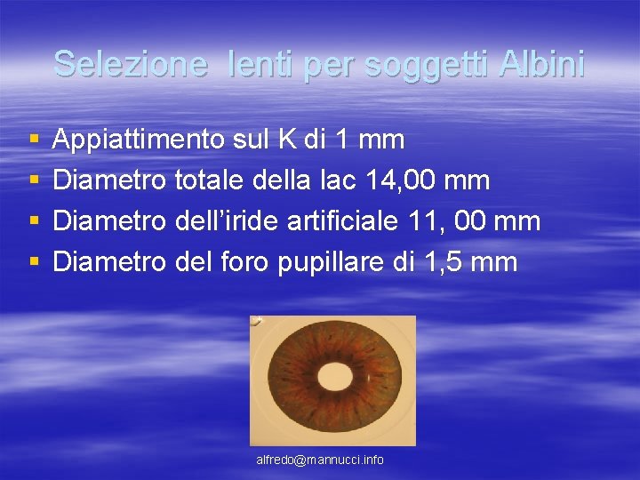 Selezione lenti per soggetti Albini § § Appiattimento sul K di 1 mm Diametro Selezione lenti per soggetti Albini § § Appiattimento sul K di 1 mm Diametro