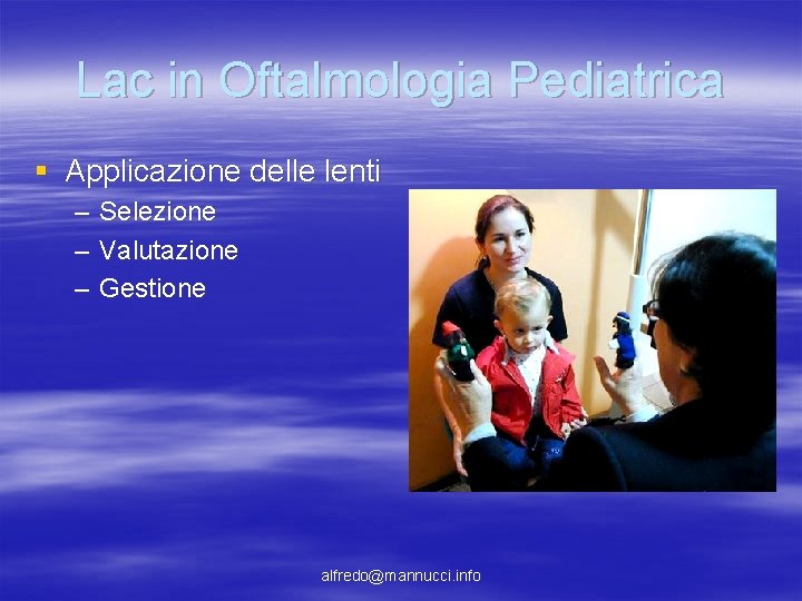 Lac in Oftalmologia Pediatrica § Applicazione delle lenti – – – Selezione Valutazione Gestione Lac in Oftalmologia Pediatrica § Applicazione delle lenti – – – Selezione Valutazione Gestione