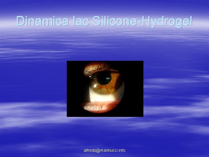Dinamica lac Silicone-Hydrogel alfredo@mannucci. info Dinamica lac Silicone-Hydrogel alfredo@mannucci. info