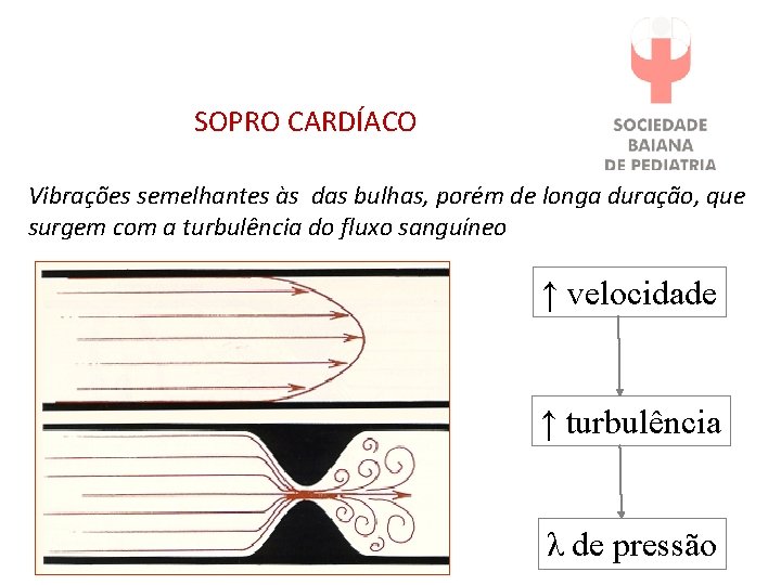 SOPRO CARDÍACO Vibrações semelhantes às das bulhas, porém de longa duração, que surgem com SOPRO CARDÍACO Vibrações semelhantes às das bulhas, porém de longa duração, que surgem com