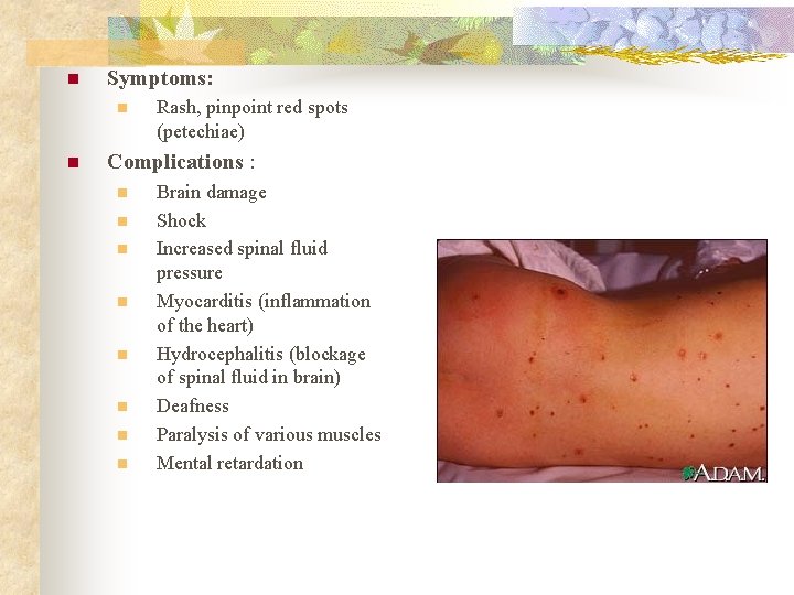 N Meningitis Rash Diseases of the Nervous System Meningitis n Haemophilus