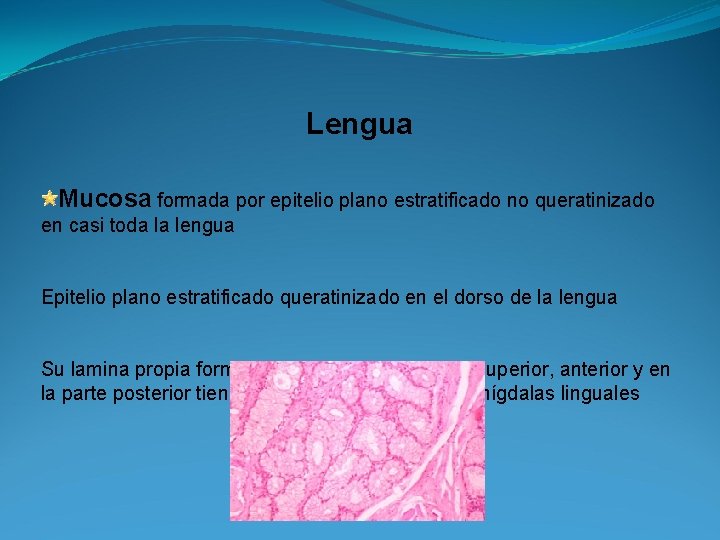 Lengua Mucosa formada por epitelio plano estratificado no queratinizado en casi toda la lengua