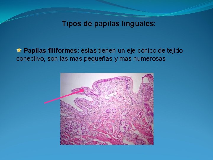 Tipos de papilas linguales: Papilas filiformes: estas tienen un eje cónico de tejido conectivo,