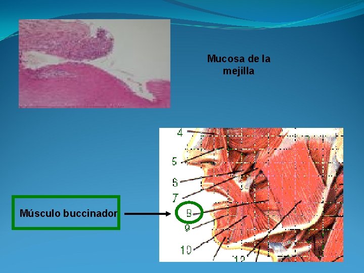 Mucosa de la mejilla Músculo buccinador 