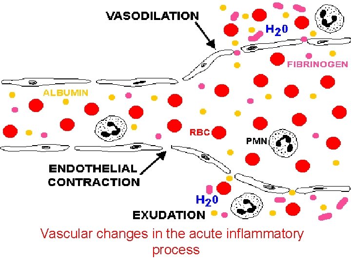 Vascular changes in the acute inflammatory process 