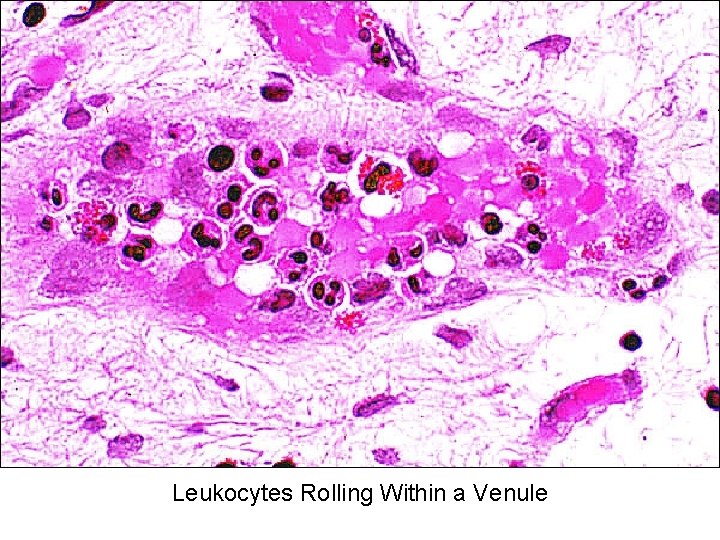 Leukocytes Rolling Within a Venule 