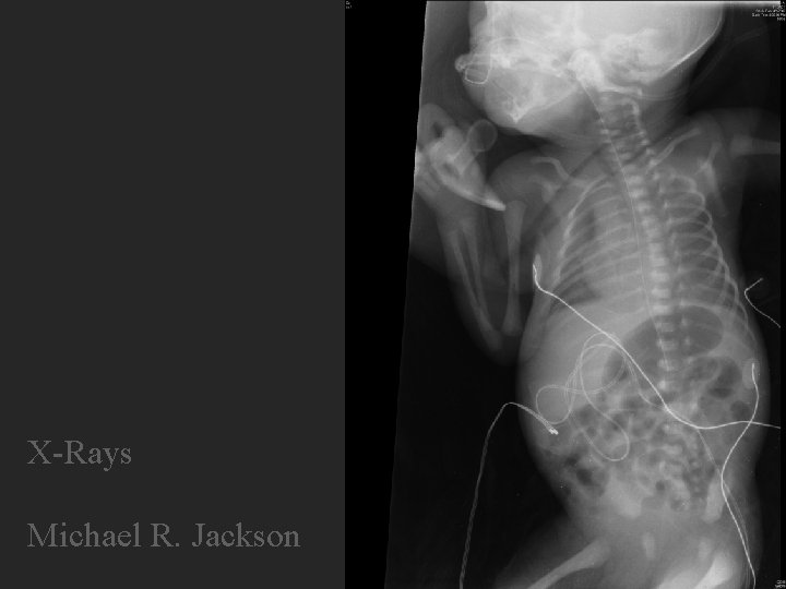 X-Rays Michael R. Jackson X-Rays Michael R. Jackson