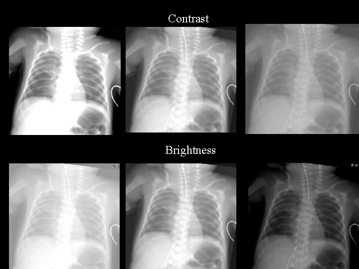 Contrast Brightness Contrast Brightness