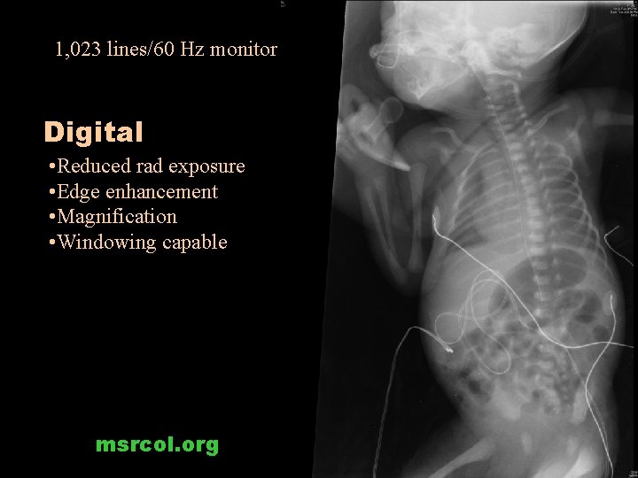 1, 023 lines/60 Hz monitor Digital • Reduced rad exposure • Edge enhancement • 1, 023 lines/60 Hz monitor Digital • Reduced rad exposure • Edge enhancement •