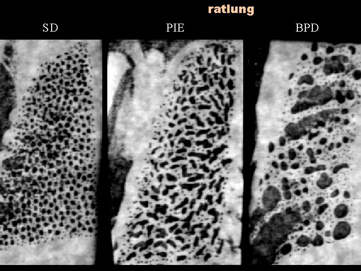ratlung SD PIE BPD ratlung SD PIE BPD