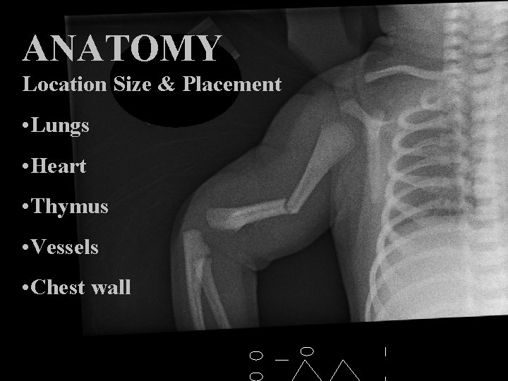 ANATOMY Location Size & Placement • Lungs • Heart • Thymus • Vessels • ANATOMY Location Size & Placement • Lungs • Heart • Thymus • Vessels •