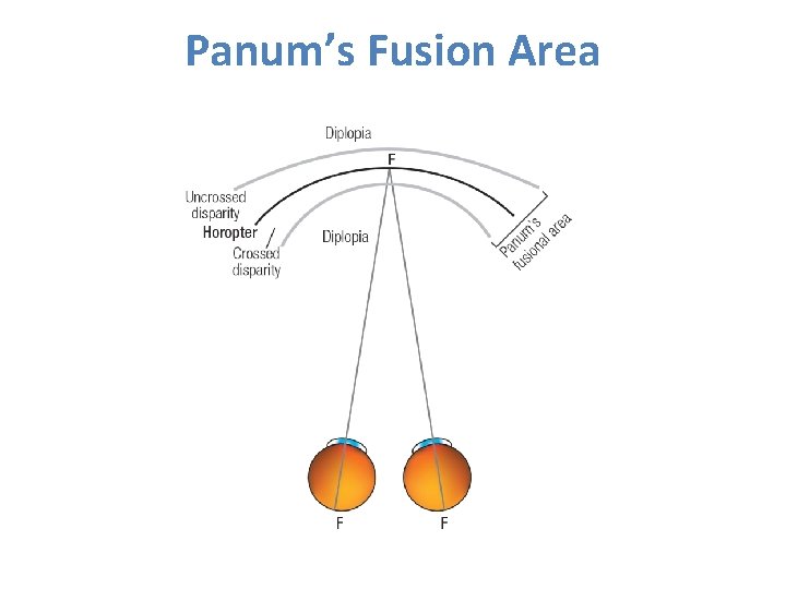 Panum’s Fusion Area Panum’s Fusion Area