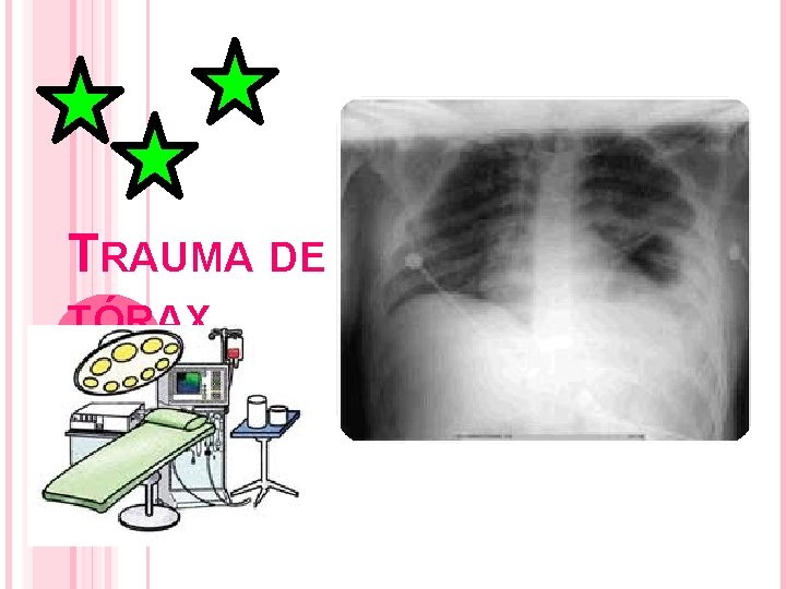 TRAUMA DE TÓRAX TRAUMA DE TÓRAX