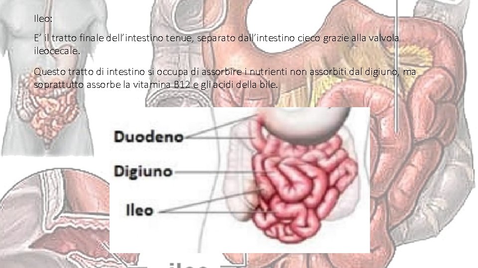 Ileo: E’ il tratto finale dell’intestino tenue, separato dall’intestino cieco grazie alla valvola ileocecale.