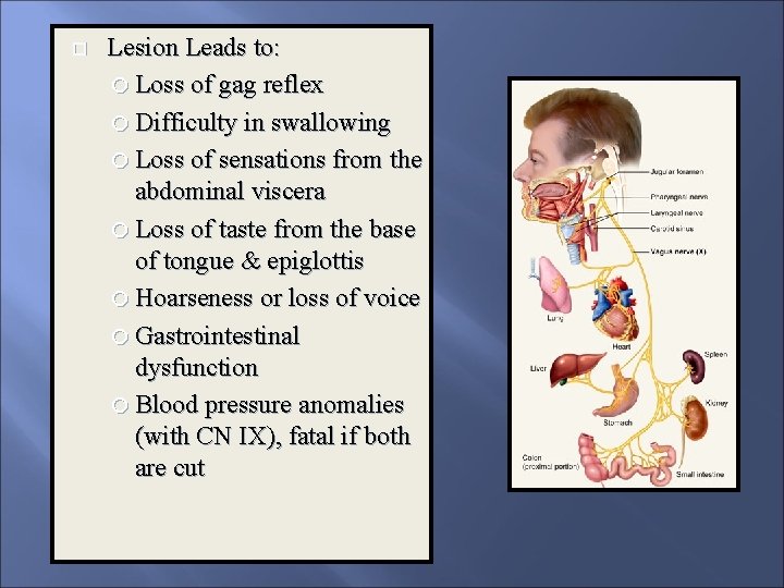  Lesion Leads to: Loss of gag reflex Difficulty in swallowing Loss of sensations