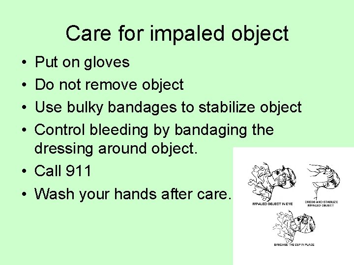 Care for impaled object • • Put on gloves Do not remove object Use