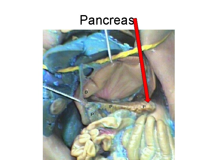 Pancreas 