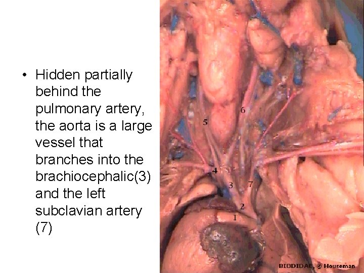 • Hidden partially behind the pulmonary artery, the aorta is a large vessel • Hidden partially behind the pulmonary artery, the aorta is a large vessel