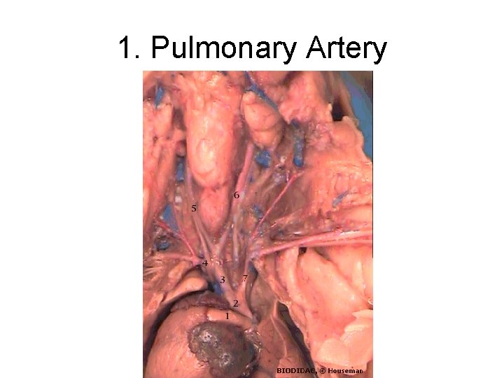 1. Pulmonary Artery 1. Pulmonary Artery