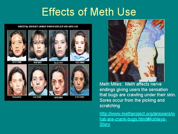 Effects of Meth Use Meth Mites: Meth affects nerve endings giving users the sensation