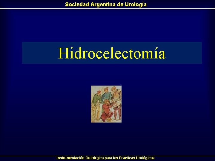 Sociedad Argentina de Urología Hidrocelectomía Instrumentación Quirúrgica para las Practicas Urológicas Sociedad Argentina de Urología Hidrocelectomía Instrumentación Quirúrgica para las Practicas Urológicas