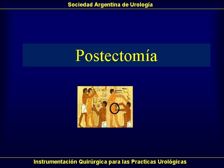 Sociedad Argentina de Urología Postectomía Instrumentación Quirúrgica para las Practicas Urológicas Sociedad Argentina de Urología Postectomía Instrumentación Quirúrgica para las Practicas Urológicas
