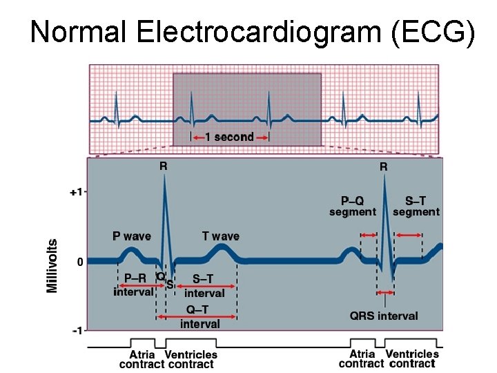 Normal Electrocardiogram (ECG) 
