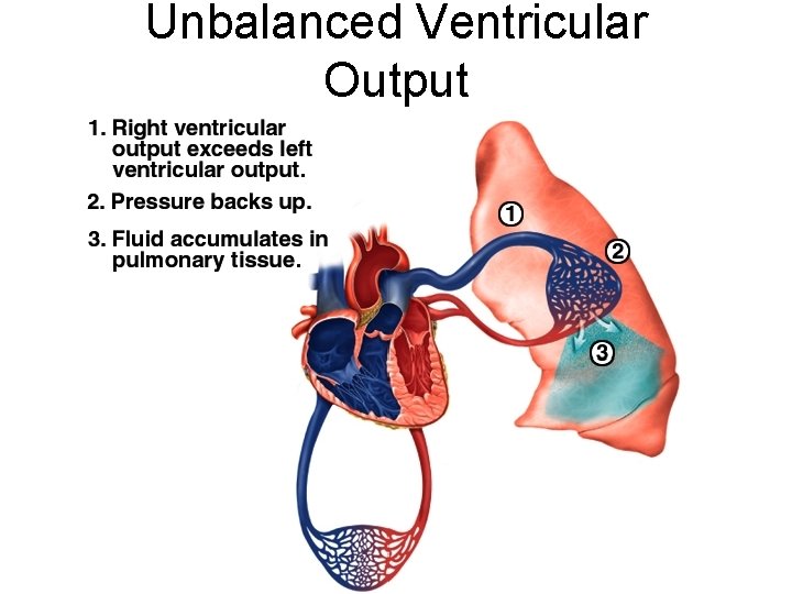 Unbalanced Ventricular Output 