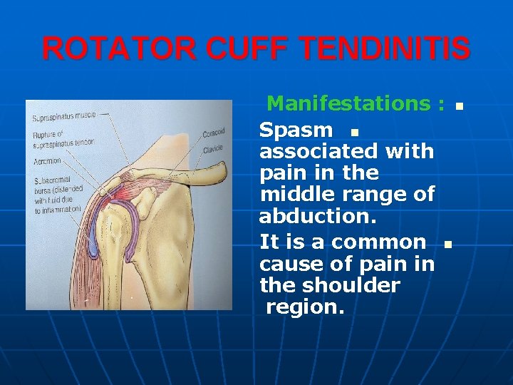 ROTATOR CUFF TENDINITIS Manifestations : n Spasm n associated with pain in the middle