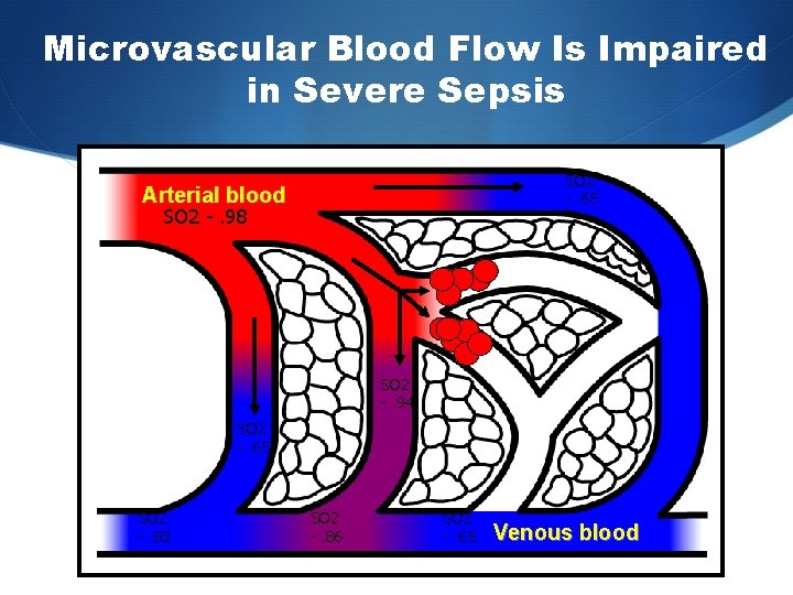 Microvascular Blood Flow Is Impaired in Severe Sepsis SO 2 -. 65 Arterial blood