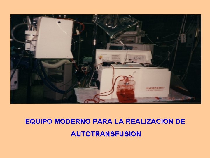 EQUIPO MODERNO PARA LA REALIZACION DE AUTOTRANSFUSION EQUIPO MODERNO PARA LA REALIZACION DE AUTOTRANSFUSION