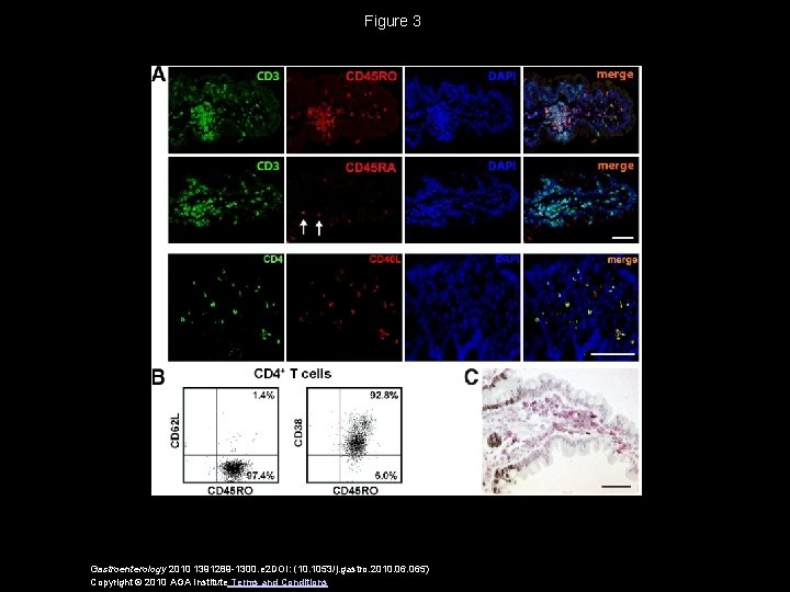 Figure 3 Gastroenterology 2010 1391289 -1300. e 2 DOI: (10. 1053/j. gastro. 2010. 065)