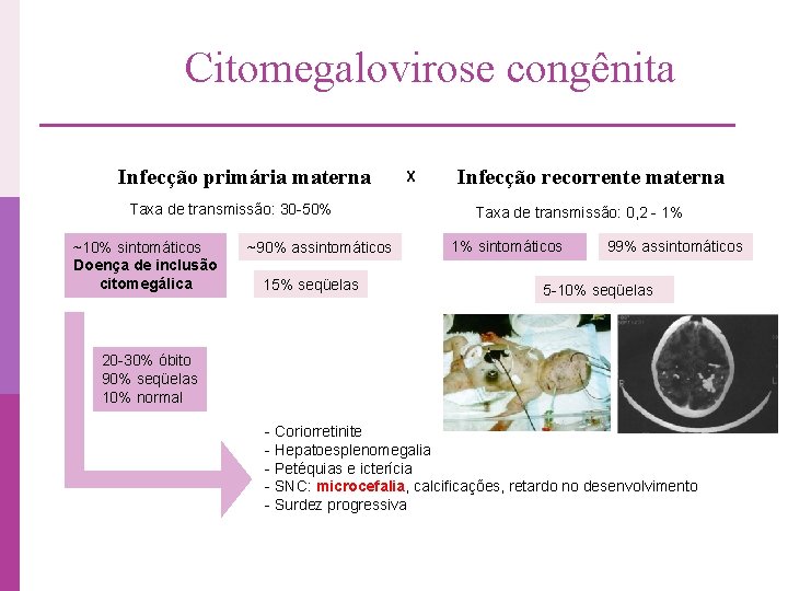 Citomegalovirose congênita Infecção primária materna Taxa de transmissão: 30 -50% ~10% sintomáticos Doença de