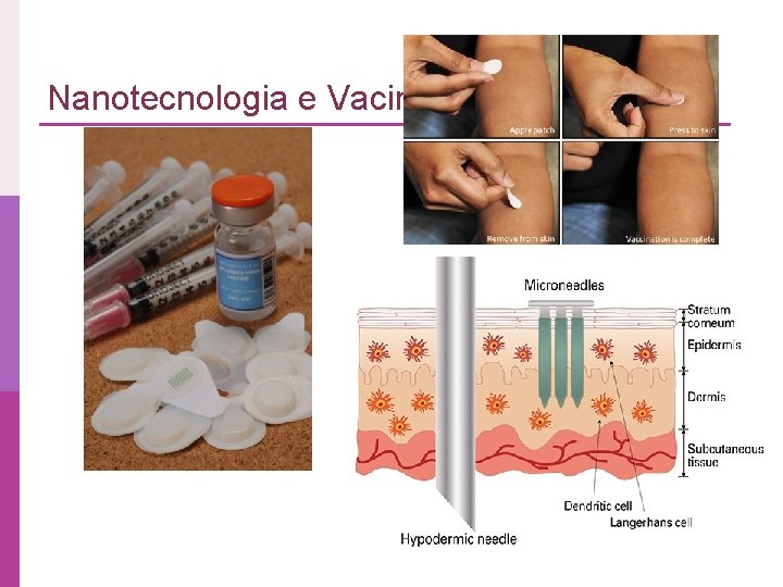 Nanotecnologia e Vacinas 