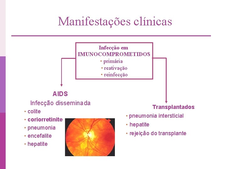 Manifestações clínicas Infecção em IMUNOCOMPROMETIDOS • primária • reativação • reinfecção AIDS Infecção disseminada