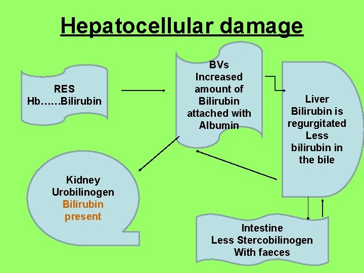 Hepatocellular damage RES Hb……Bilirubin Kidney Urobilinogen Bilirubin present BVs Increased amount of Bilirubin attached