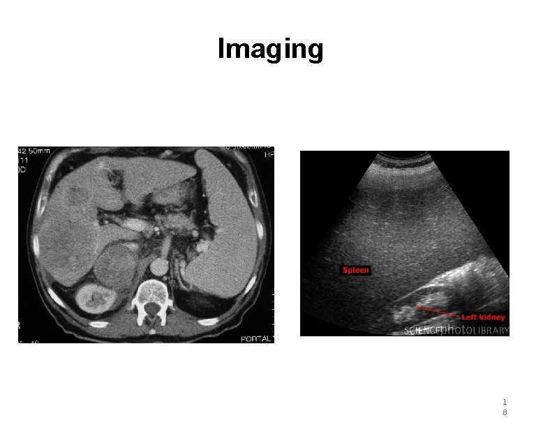Imaging 1 8 Imaging 1 8