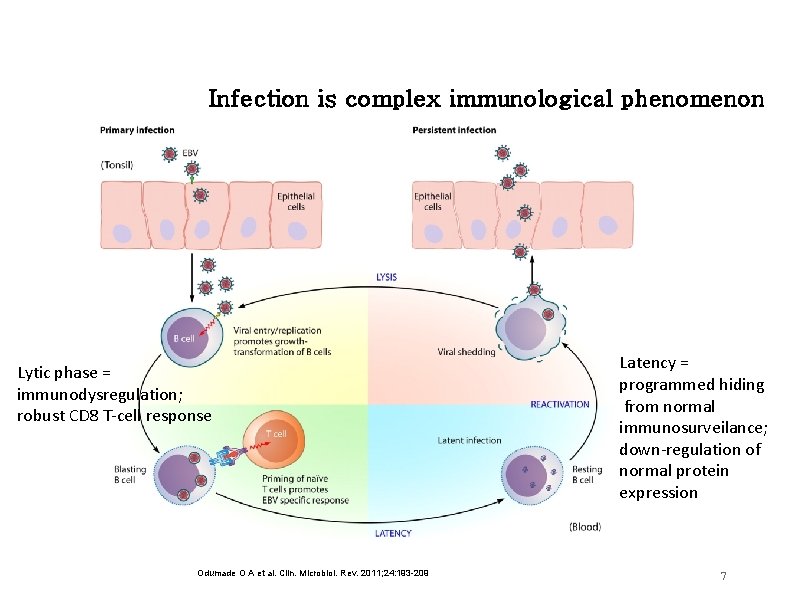 Infection is complex immunological phenomenon Lytic phase = immunodysregulation; robust CD 8 T-cell response Infection is complex immunological phenomenon Lytic phase = immunodysregulation; robust CD 8 T-cell response
