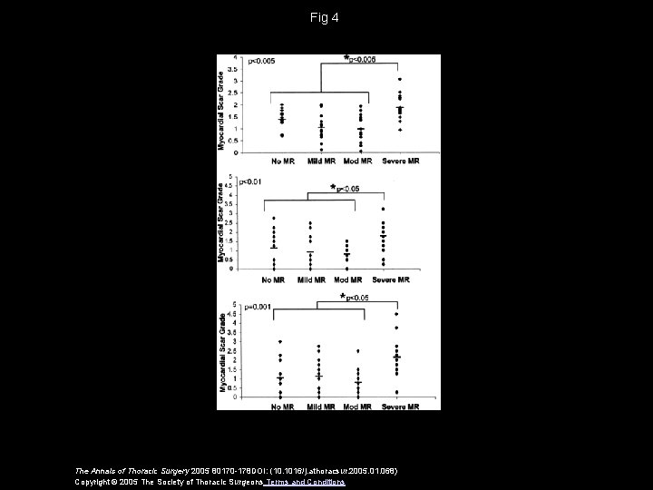 Fig 4 The Annals of Thoracic Surgery 2005 80170 -178 DOI: (10. 1016/j. athoracsur.