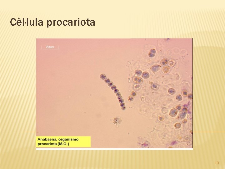 Cèl·lula procariota 13 