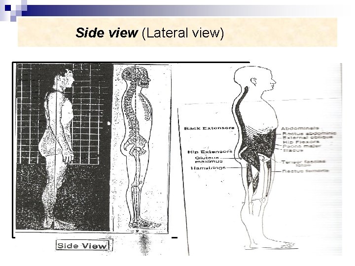 Side view (Lateral view) 