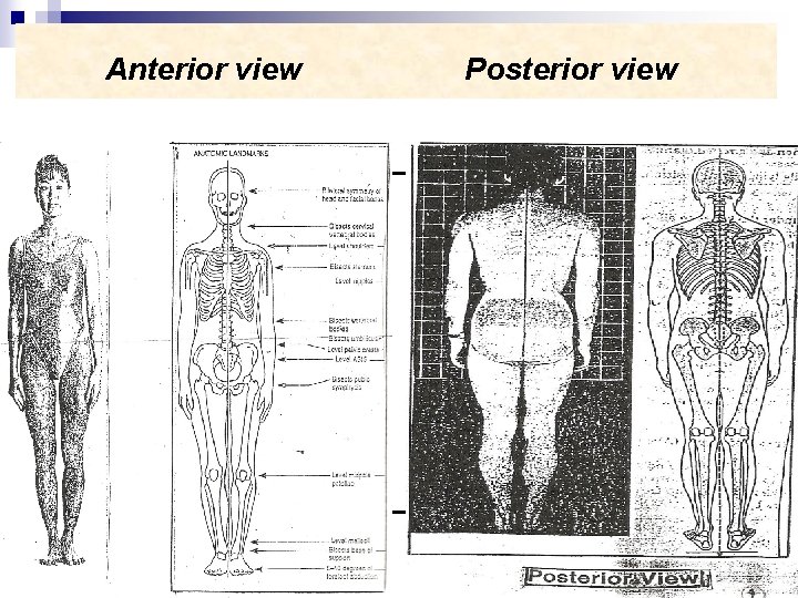 Anterior view Posterior view 