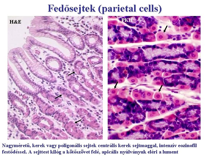 Fedősejtek (parietal cells) H&E PKH Nagyméretű, kerek vagy poligonális sejtek centrális kerek sejtmaggal, intenzív