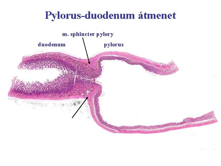 Pylorus-duodenum átmenet m. sphincter pylory duodenum pylorus 