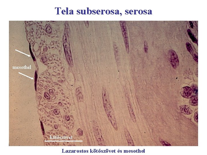 Tela subserosa, serosa mesothel kötőszövet Lazarostos kötőszövet és mesothel 