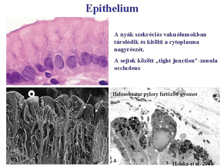 Epithelium A nyák szekréciós vakuólumokban tárolódik és kitölti a cytoplasma nagyrészét. A sejtek között