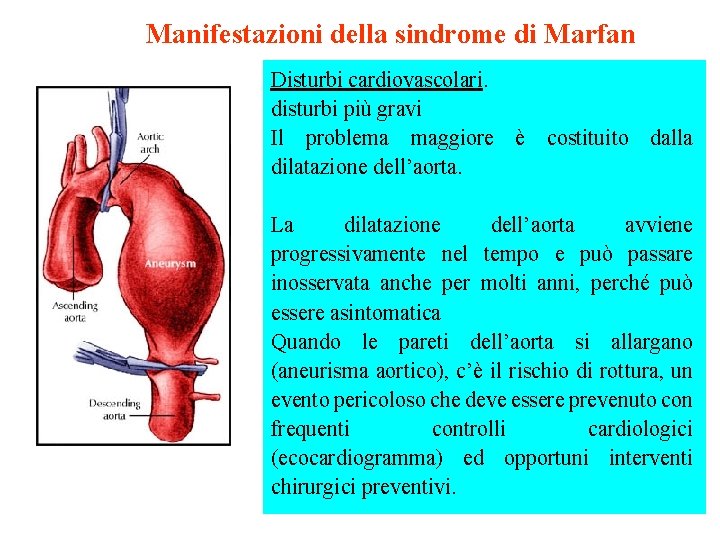 Manifestazioni della sindrome di Marfan Disturbi cardiovascolari. disturbi più gravi Il problema maggiore è